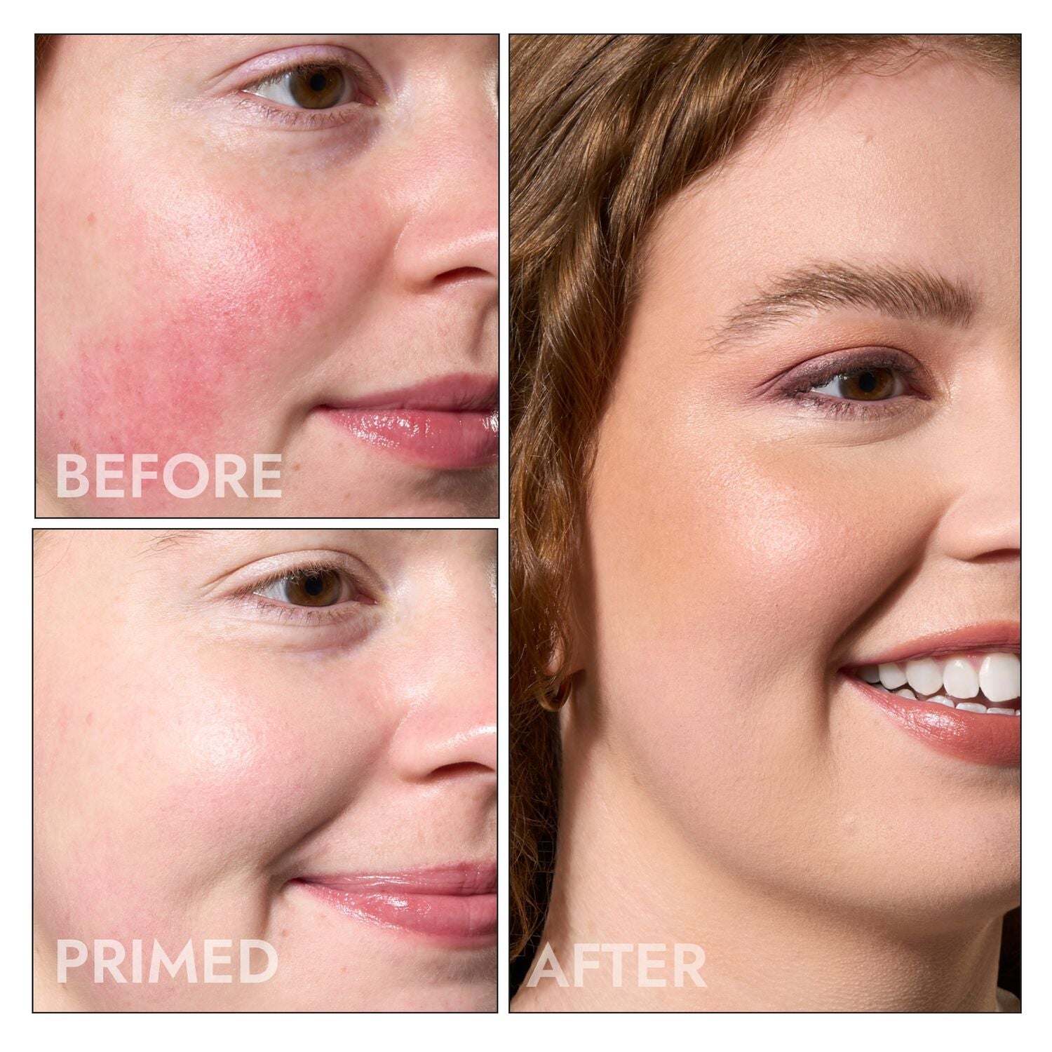 The Acne & Redness Kit (3 PC)